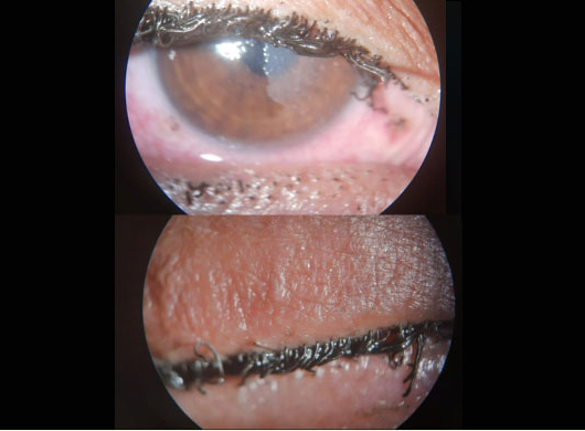 Electrical Injury Image 1