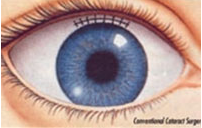 Conventional Technique