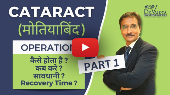 cataract-operation cataract operation kab kare part 1