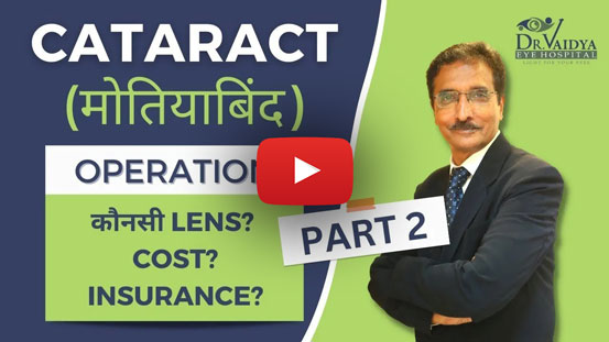 cataract-surgery cataract operation kab kare part 2